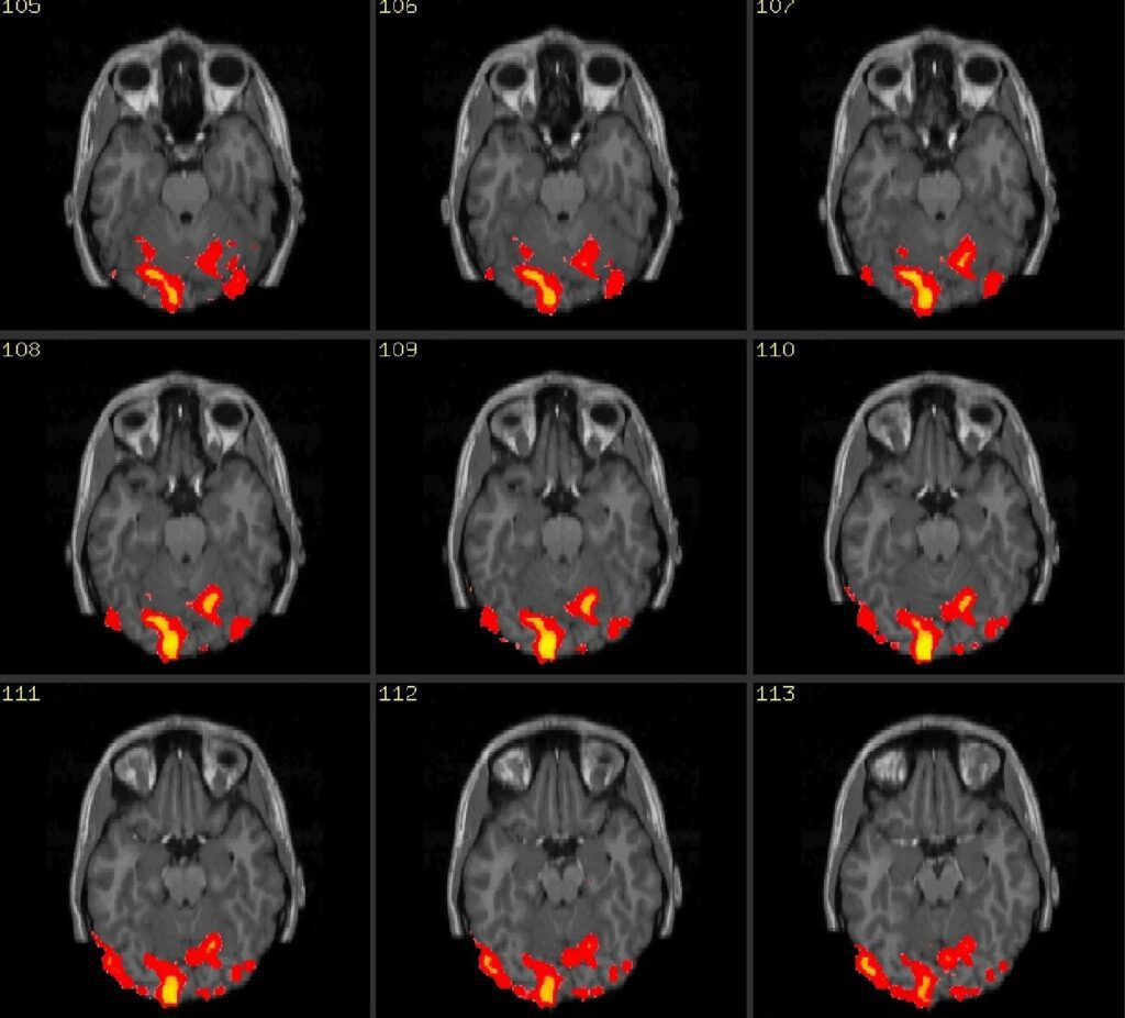 بررسی کاربردهای هوش مصنوعی در روانشناسی 4 کاربرد هوش مصنوعی در روانشناسی شناختی